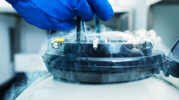 Image of a hand over a liquid nitrogen tank used for vitrification of gametes